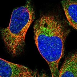 Choline Kinase beta Antibody, Novus Biologicals:Antibodies:Primary Antibodies